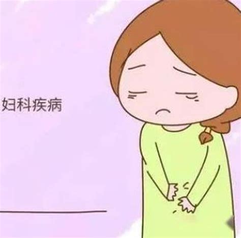 婦科病|婦科疾病列表